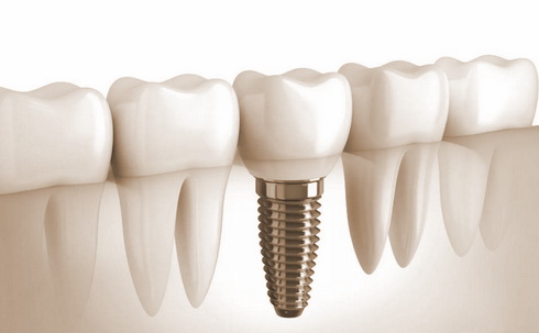 относится ли лечение зубов к перечню дорогостоящего лечения для 3 НДФЛ в стоматологии